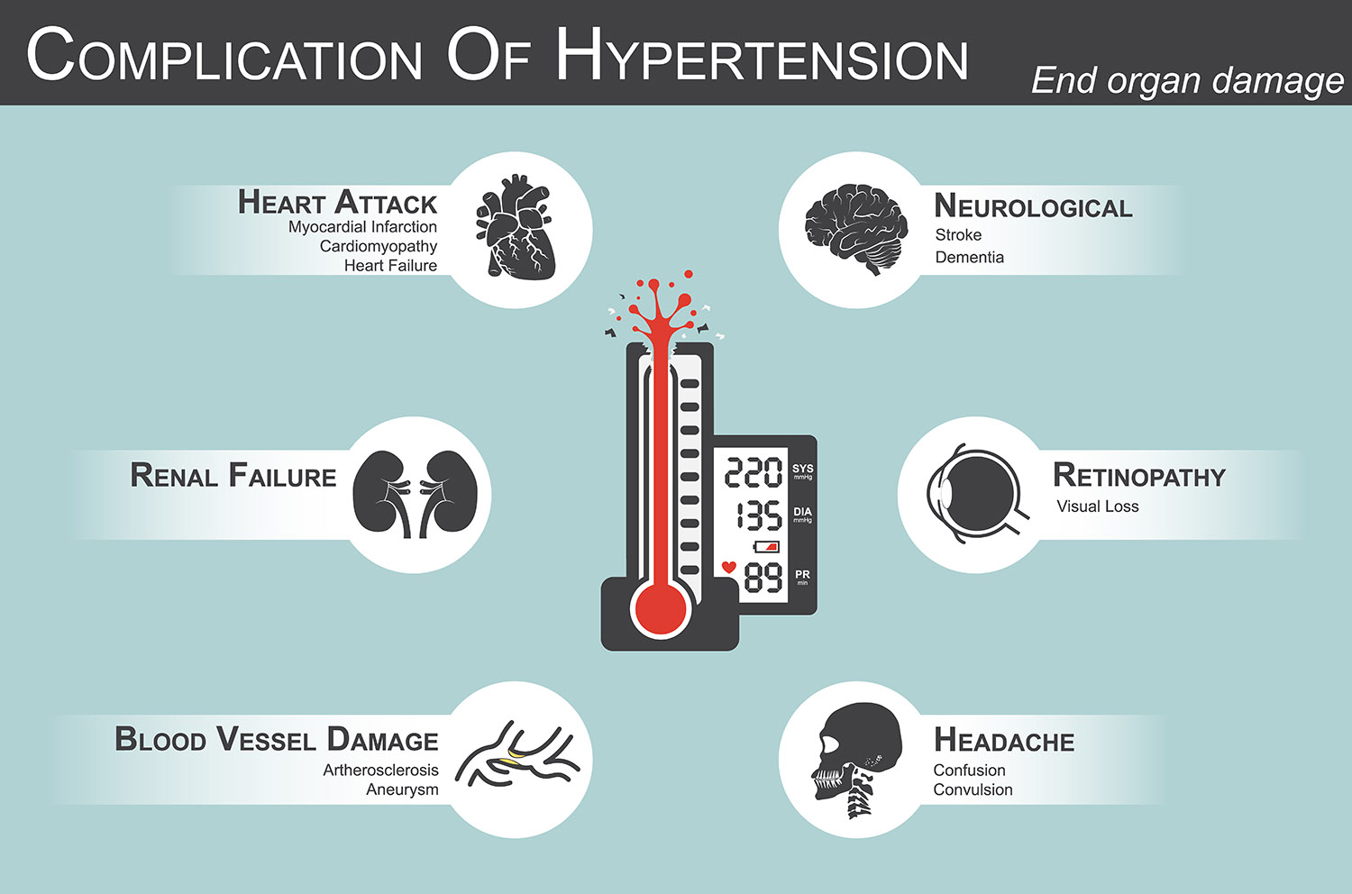 cannabis-and-hypertension-sensi-seeds-blog