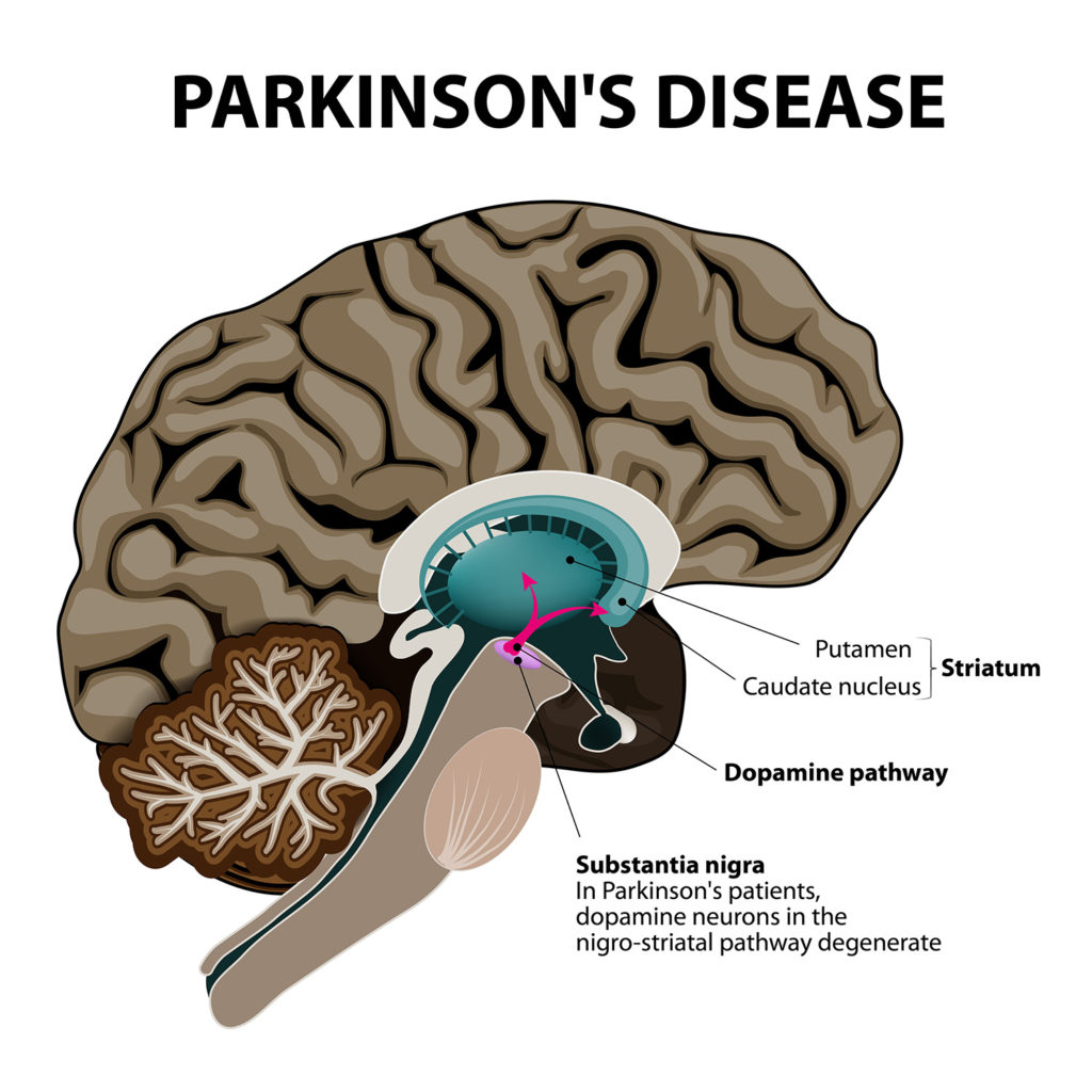 cannabis-and-parkinson-s-disease