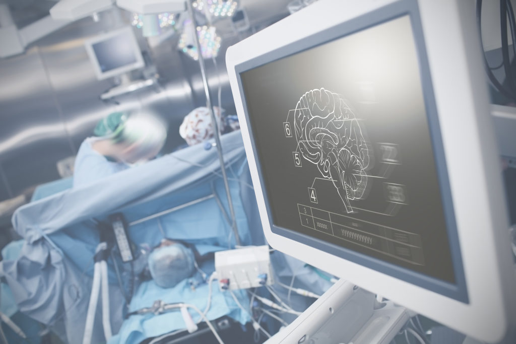 Los efectos neuroprotectores del cannabis - Sensi Seeds Blog