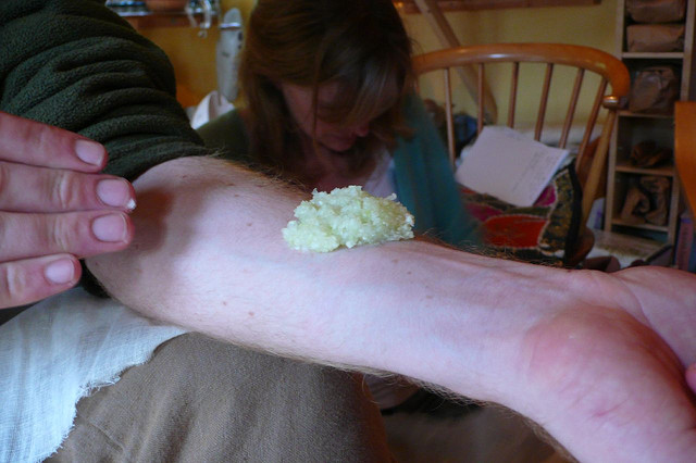 Like this chopped cabbage compress, raw, crushed hemp root was used in traditional medicine to treat burns, skin complaints and cuts (© Smoobs)
