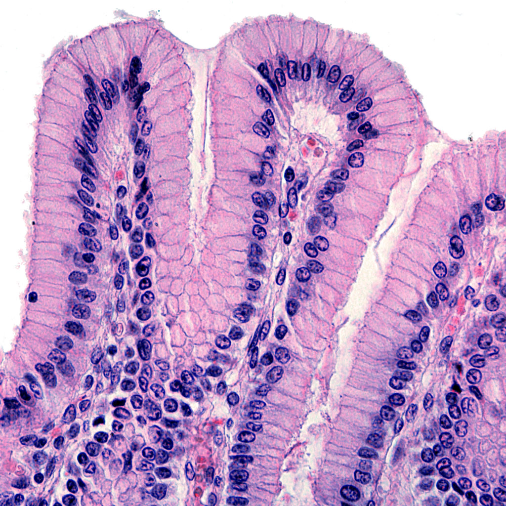 Cannabinoids also promote wound-healing in the epithelium that coats the internal organs