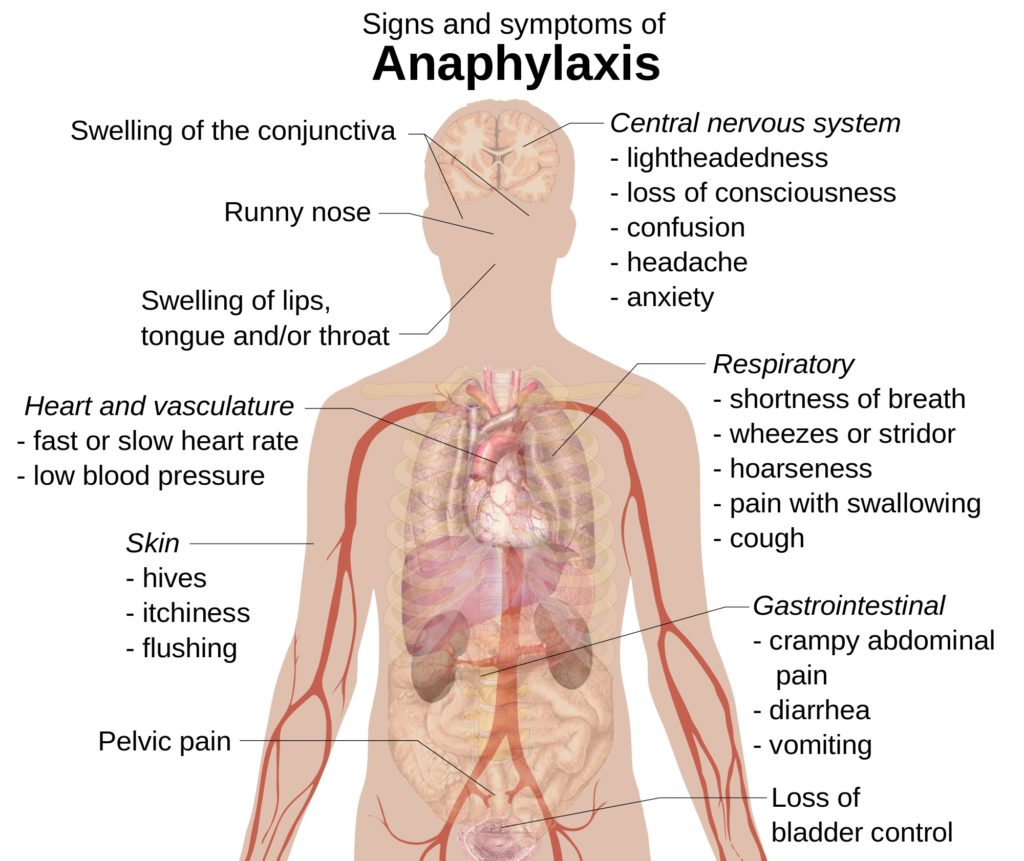 Dans de très rares instances, il peut y avoir choc anaphylactique