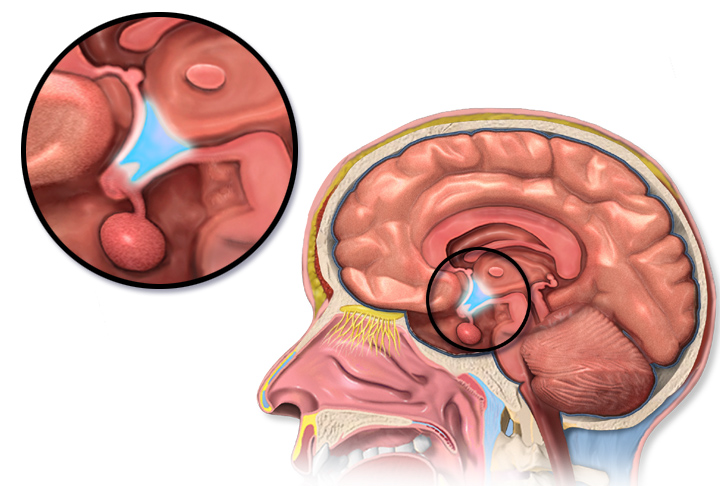The hypothalamus is responsible for generating sensations of hunger