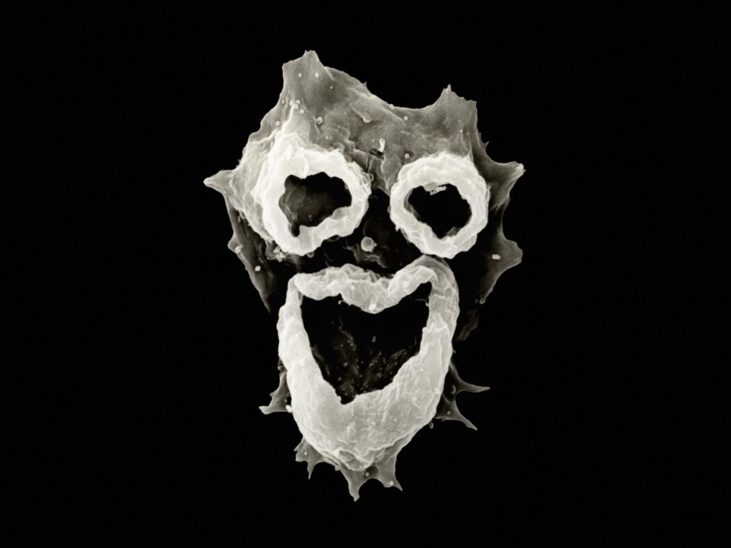 Hiiii! I’m coming to eat your brain! N. fowleri “brain-eating” amoeba