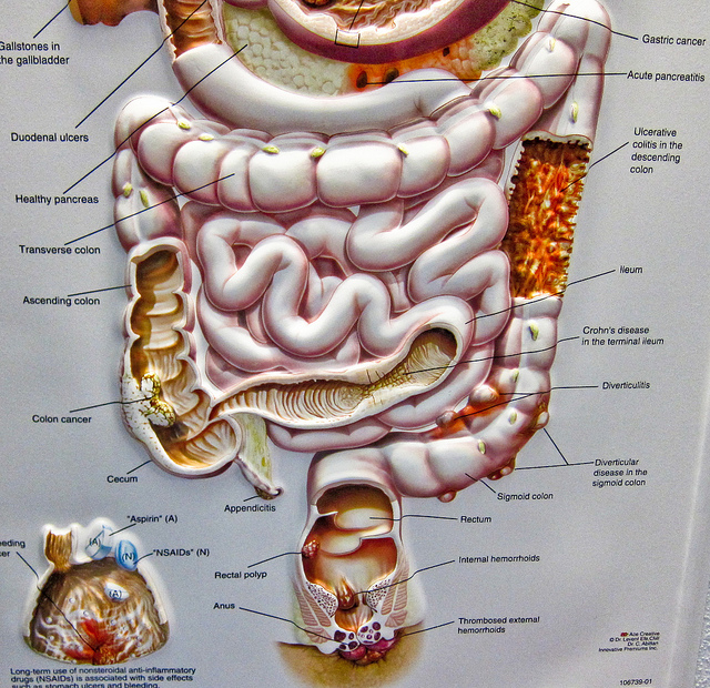 CBD kann zur Behandlung diverser Erkrankungen des Magen-Darm-Trakts beitragen, u.a. von Morbus Crohn, Colitis sowie weiterer Formen chronisch-entzündlicher Darmerkrankungen (IBD) (© ex_magician)