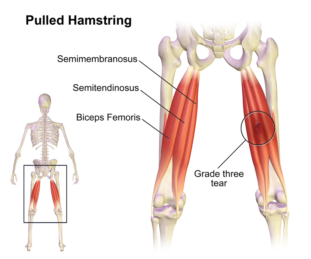 Cannabis use during exercise can reduce chance of inflammation and muscle injury (© Wiki Commons)