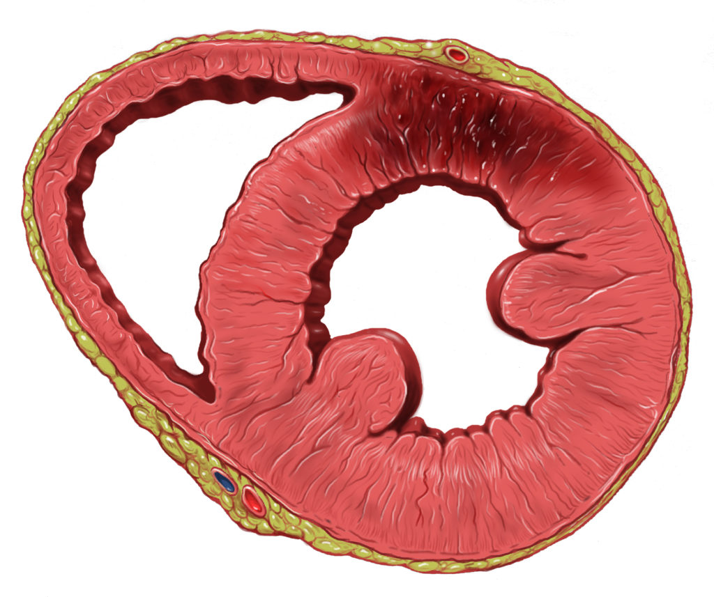 In some rare cases, cannabis may increase risk of heart attack (© Wiki Commons)
