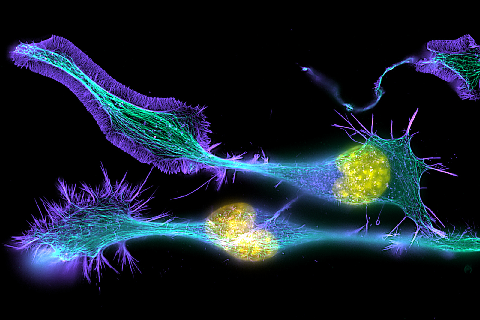 CBC lindert Schmerzen, die durch Schädigung der Nervenzellen verursacht werden (© ZEISS Microscopy)