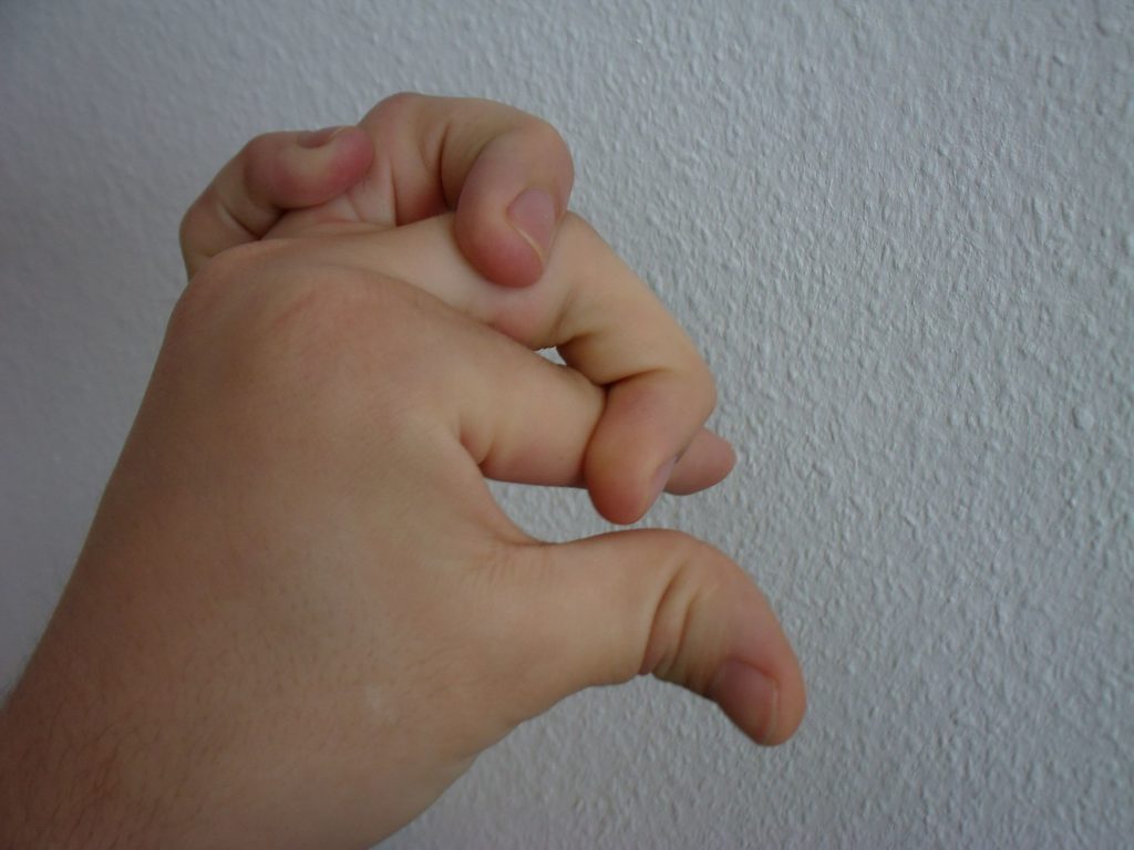 El síndrome de Ehlers-Danlos provoca hipermovilidad de las articulaciones (© Wikipedia.org)