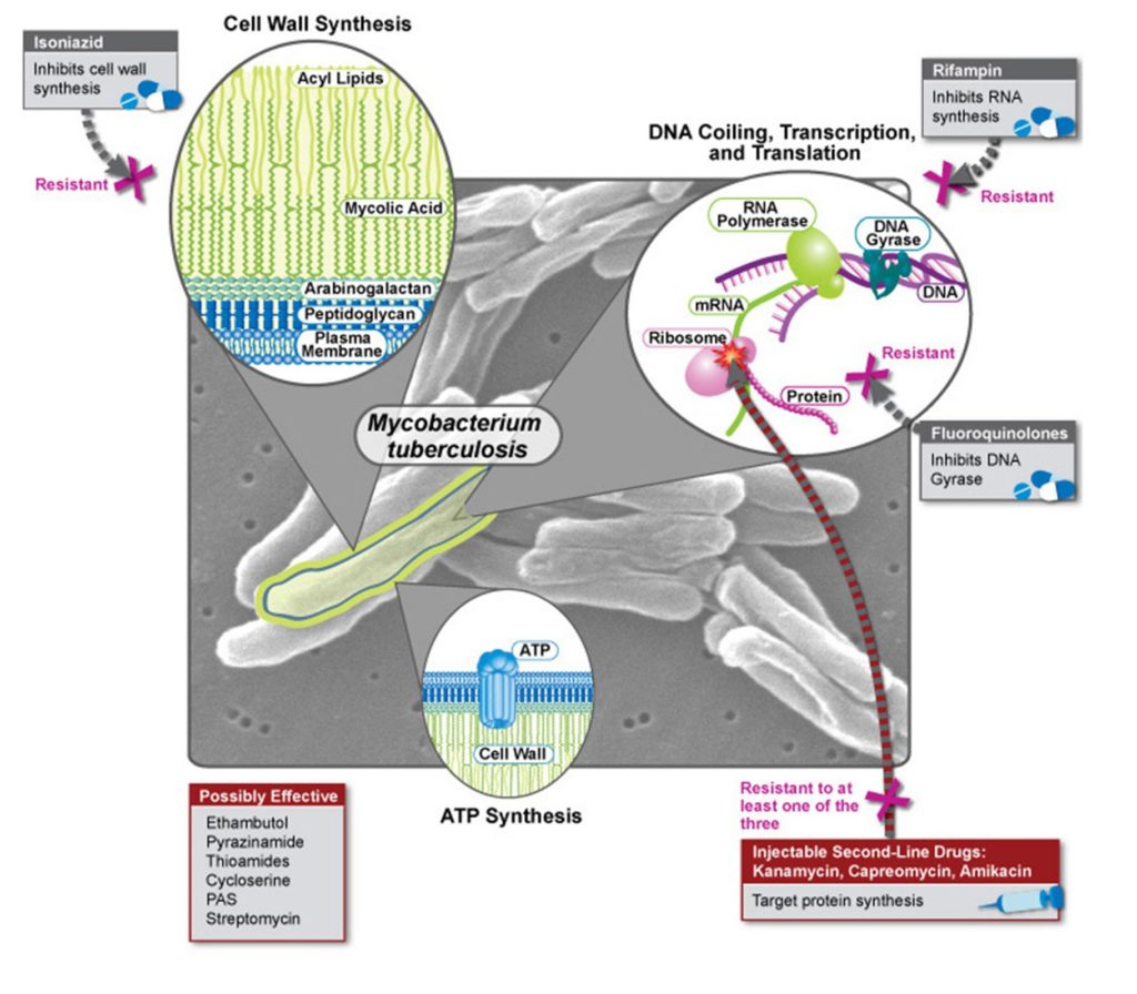 A diagram of how tuberculosis affects the body