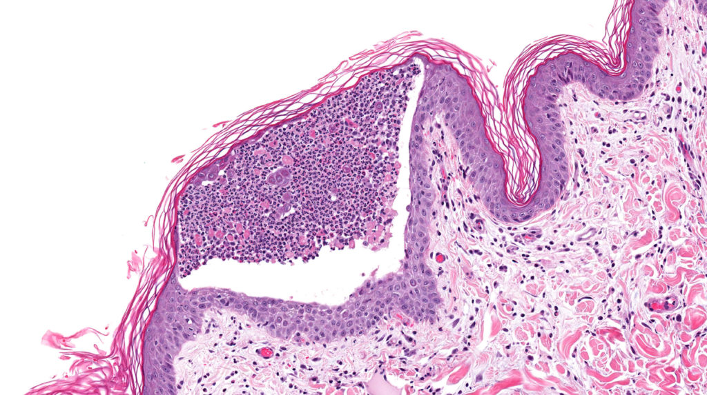 Un primer plano de las células en varios tonos de color rosa y púrpura.