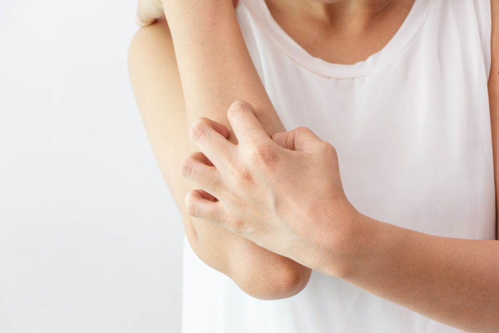 A woman in a white shirt scratching her forearm