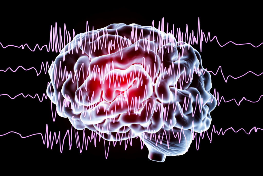 Cerebro humano animado con epilepsia