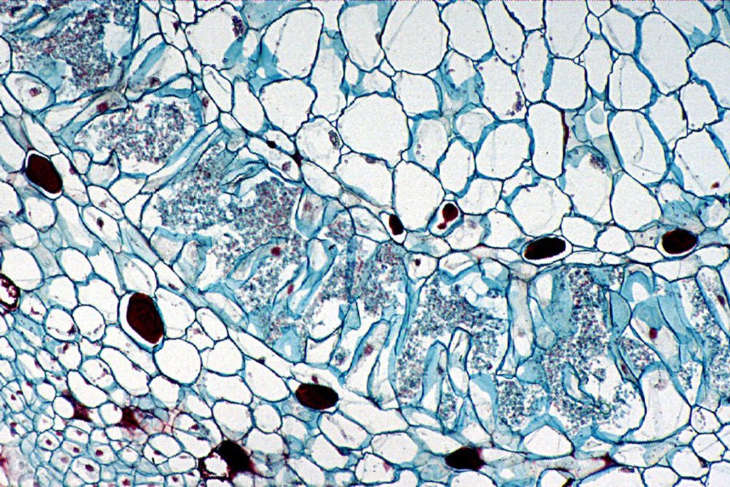 Microbiome sous un microscope