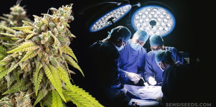 Cuatro médicos realizan una cirugía y una planta de cannabis.