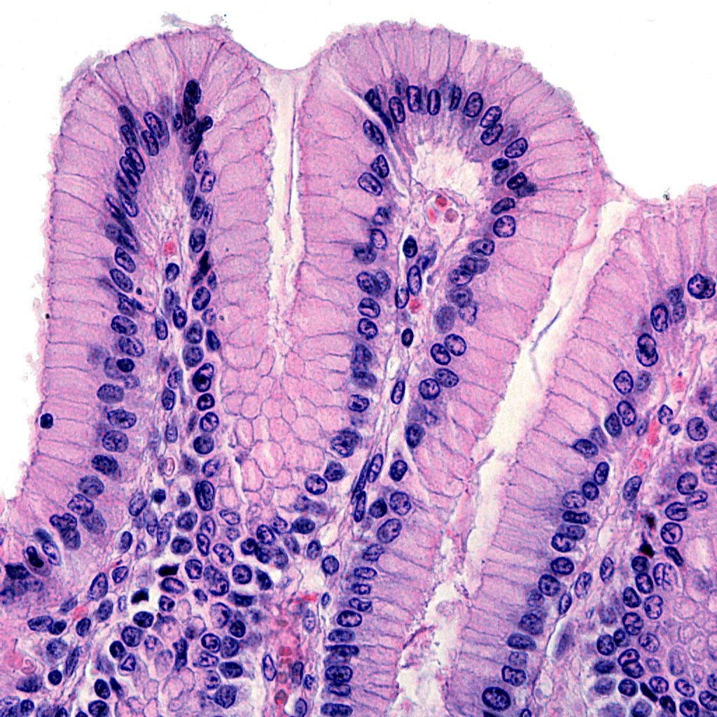 A microscopic view of epithelium