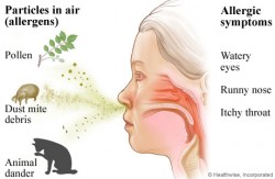 Cannabis kann bei dafür anfälligen Personen Rhinitis-Symptome auslösen