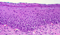 Cannabinoids also promote wound-healing in the epithelium that coats the internal organs (© Euthman)