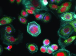 Células de cáncer de mama in vitro Células de cáncer de mama in vitro, © GE Healthcare