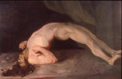 Cuadro de Sir Charles Bell, 1809, en el que se representa la frecuente espalda arqueada de los enfermos de tétanos (Wikimedia Commons)