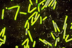 La bacteria Clostridum tetani, responsable de causar el tétanos (Sanofi Pasteur)