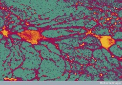 It has been shown that CBD protects the neurons of the hippocampus from destruction following brain injury (Wellcome Images)
