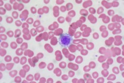 La serotonina liberada por las plaquetas de la sangre causa el dolor de migraña (© Euthman)
