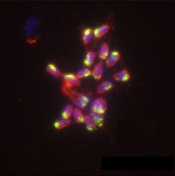 Infection d’un globule rouge par un parasite plasmodium falciparum (The JCB).