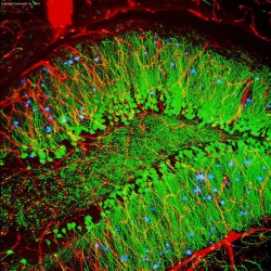 Les zones bleues sur cette image indiquent des plaques dans les tissus cérébraux causés par la maladie d’Alzheimer, qui peuvent être réduites par les thérapies à base de cannabinoïde (© ZEISS Microscopy).